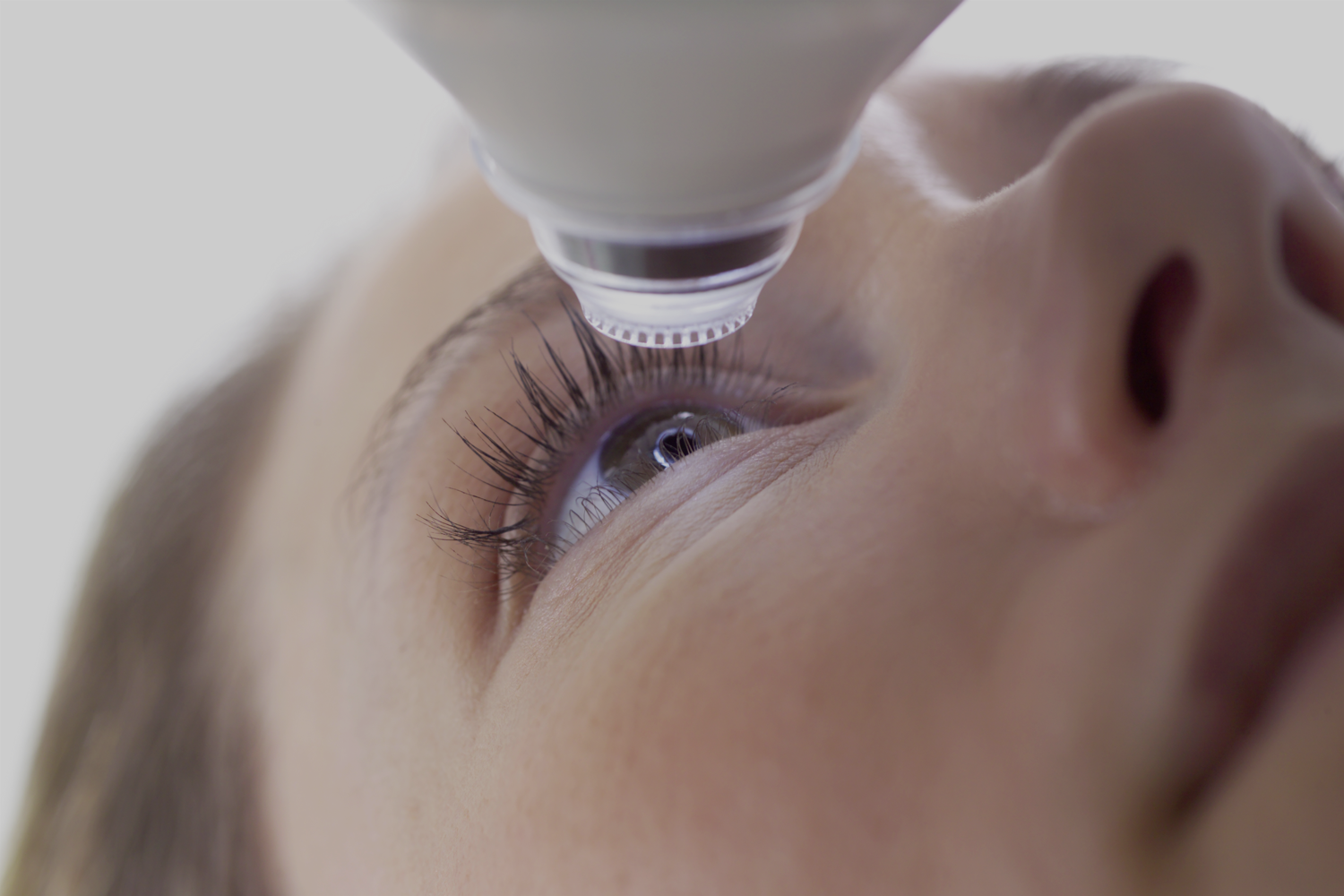 Centre laser - se faire opérer des yeux- Clinique New Vision Nice - chirurgie refractive - correction des yeux - trouble de la vision